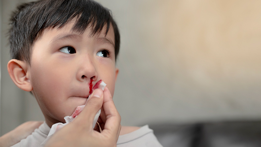 Child Nose Bleeding
