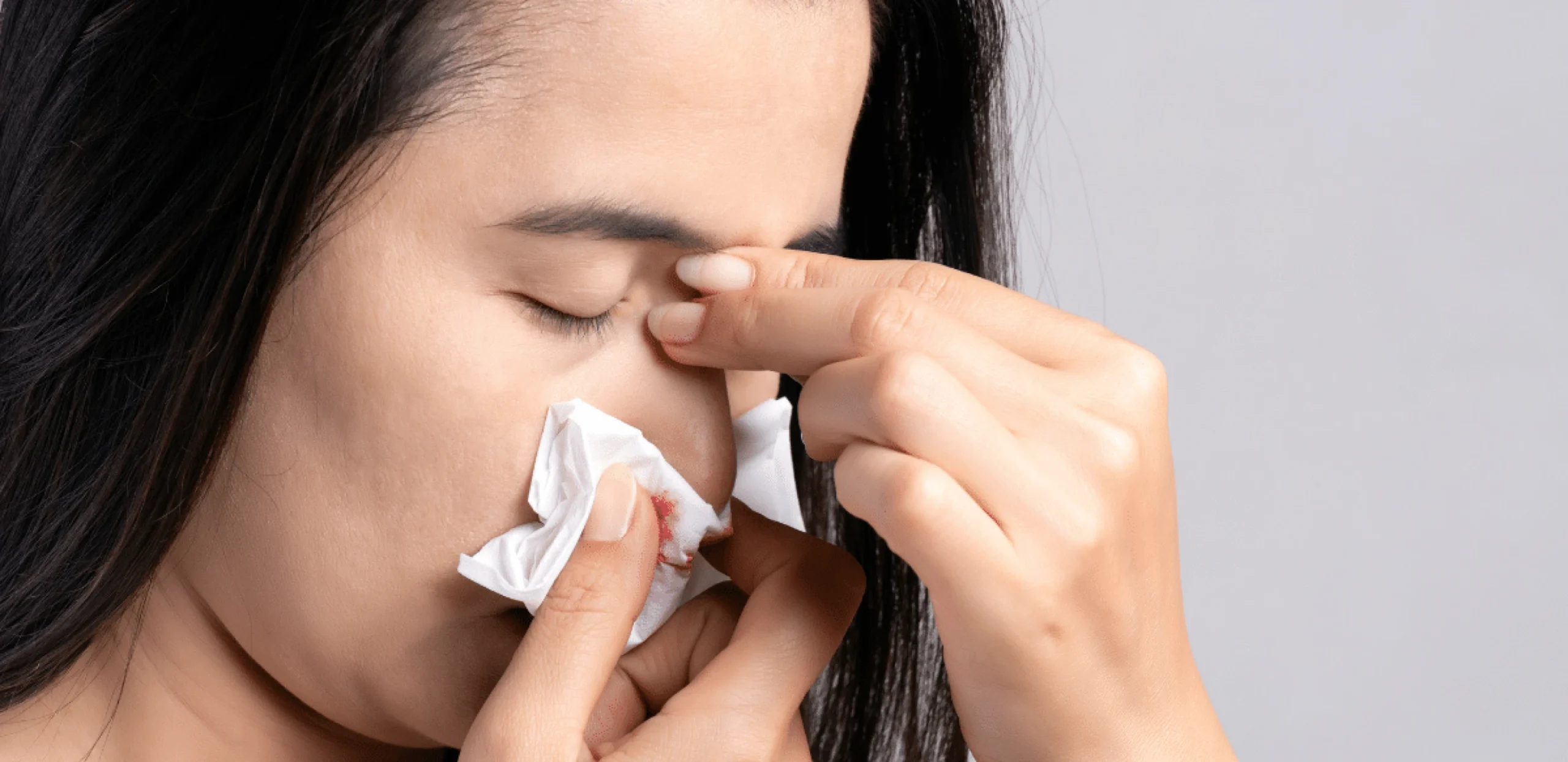 Read more about the article Bleeding Nose