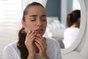 Mouth Ulcers