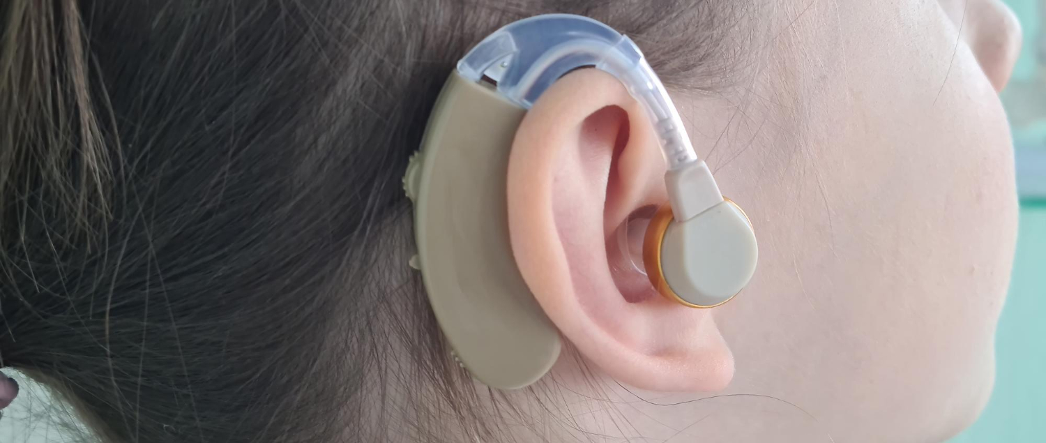 Read more about the article Cochlear Implants