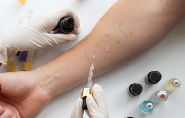 AllergyTesting-
