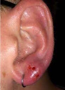 embedded-earrings